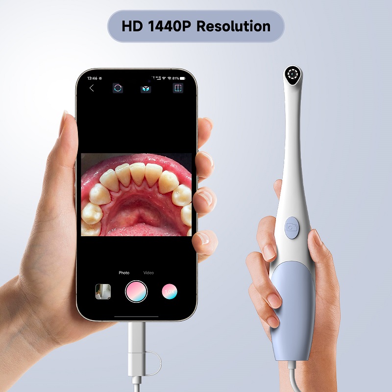 Oral Endoscope Camera 1440P Ph - Photography Lighting Continuous 评论和价格