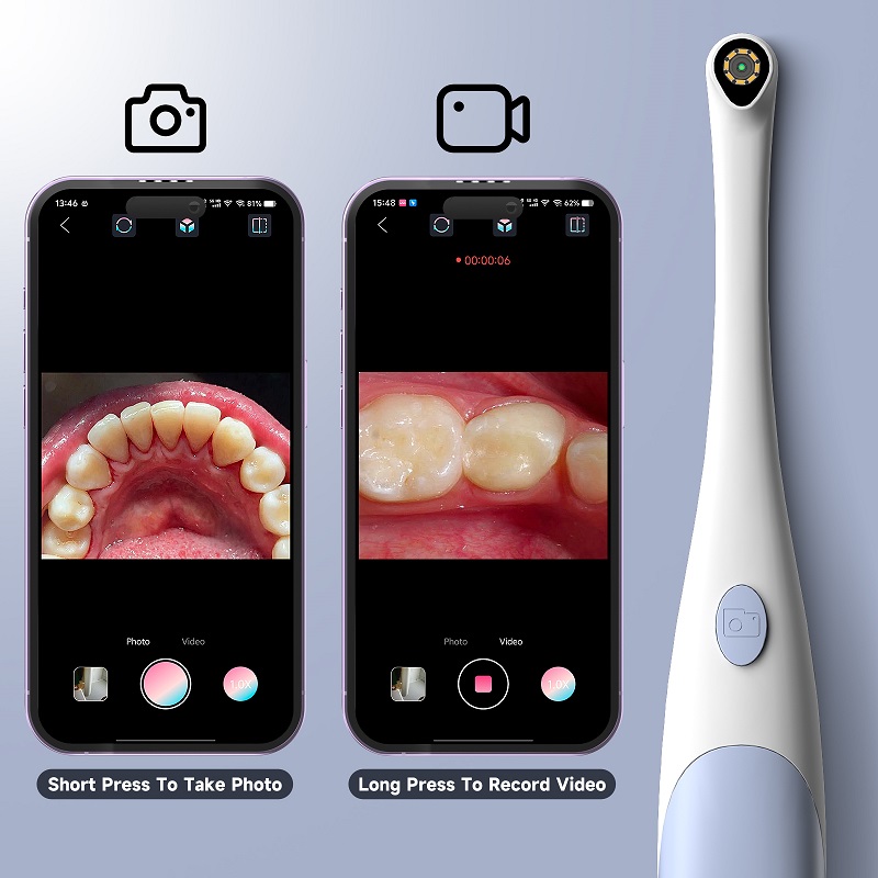 Oral Endoscope Camera 1440P Ph - Photography Lighting Continuous 评论和价格